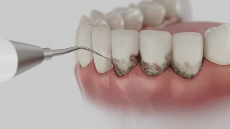 Reliable Teeth Cleaning And Checkup contractor in Montgomery County County, KS by Dentist Open Now